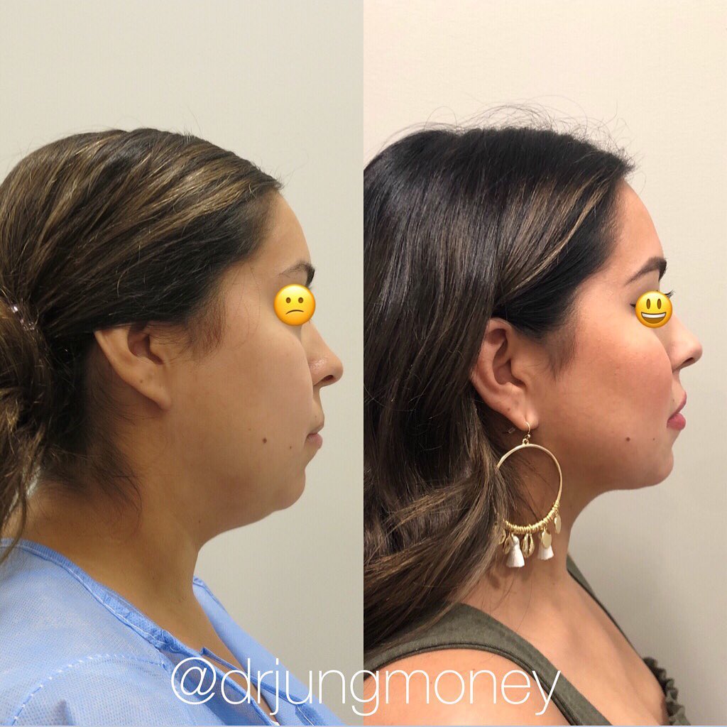 https://premieresurgicalarts.com/wp-content/uploads/2021/07/Best-blepharoplasty-surgeon-Houston.jpg