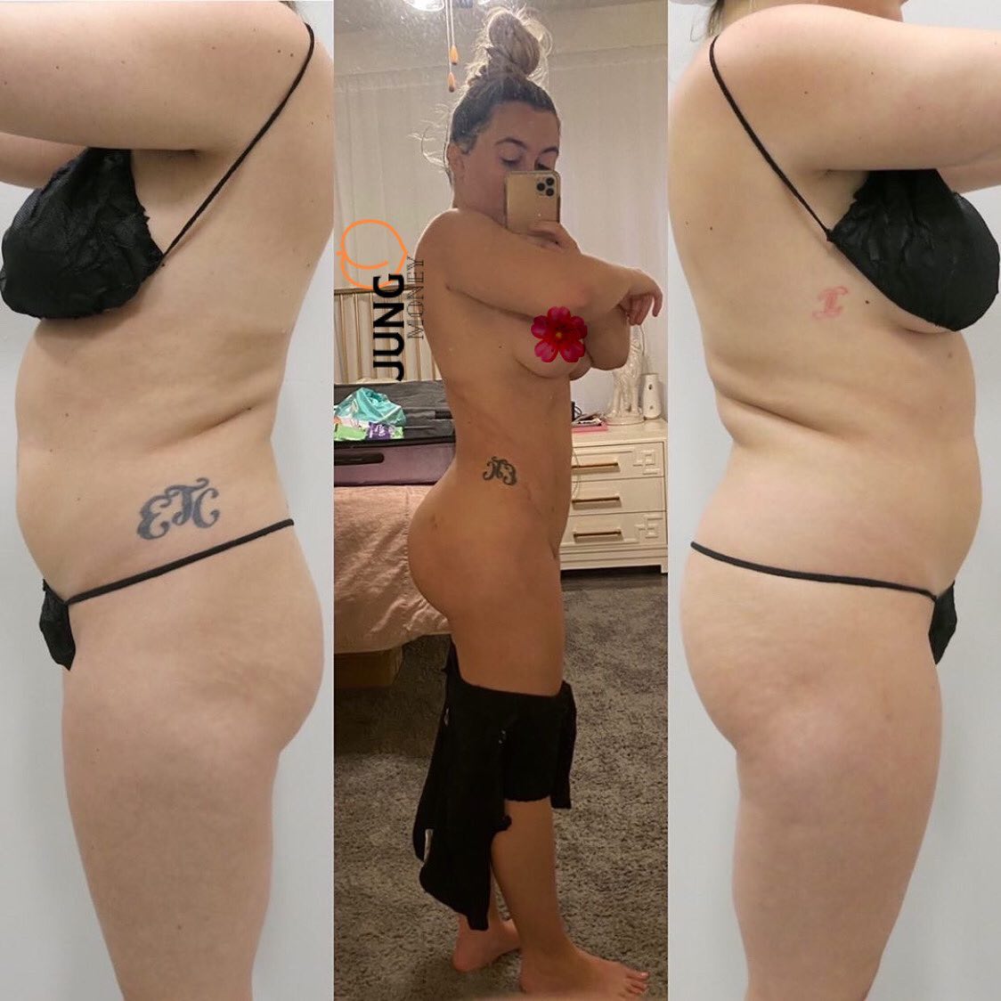 https://premieresurgicalarts.com/wp-content/uploads/2021/07/Full-body-liposuction-cost.jpg