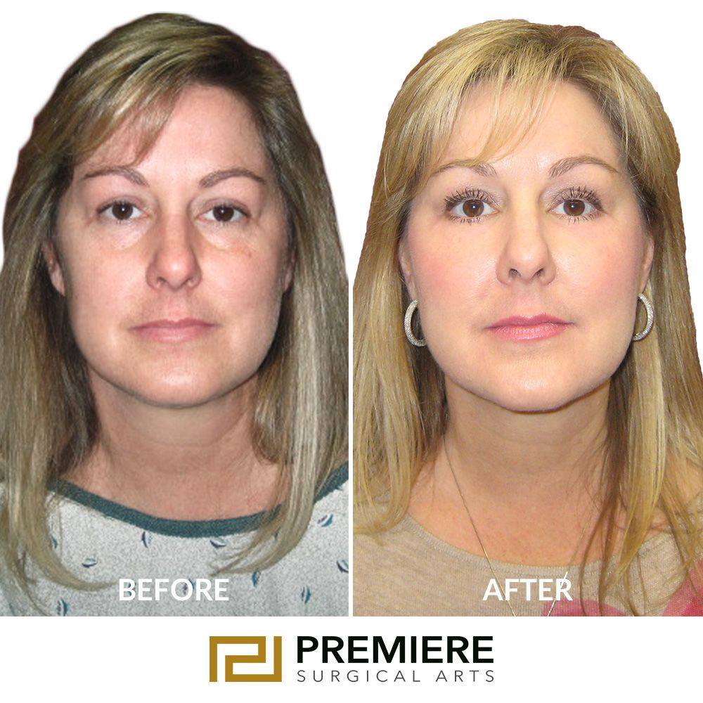 https://premieresurgicalarts.com/wp-content/uploads/2021/08/Houston-plastic-surgery-Center.jpg